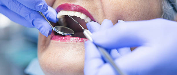 Best Dental Abscess Treatment in Ruston, WA